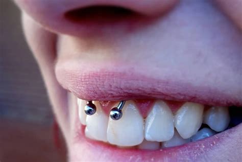 how long does a smiley piercing last|Smiley Piercing: Pain, Risks, Jewelry, Healing, & Aftercare